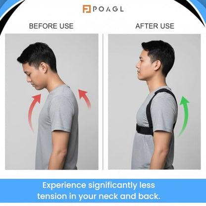 Adjustable Posture Corrector Brace for Men Universal Fit Upper Back, Shoulder & Clavicle Support, Helps Improve Posture & Relieve Neck, Shoulder & Back Pain (Patented Design)