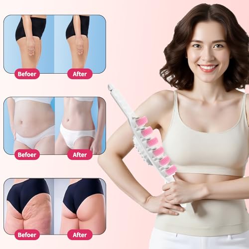 Docemel Cellulite Massage Tool for Legs,Thighs,and Arms–Lymphatic Drainage Massager for Pain Relief and Body Sculpting,Muscle Roller Stick for Circulation Support